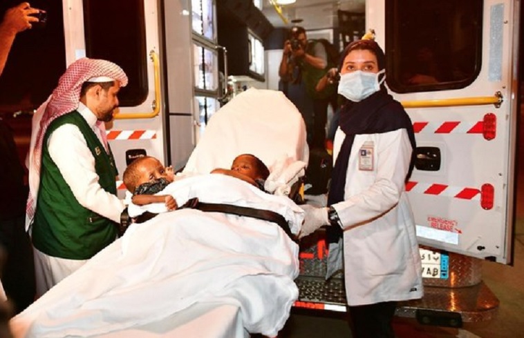Tanzanian conjoined twins arrive in Saudi