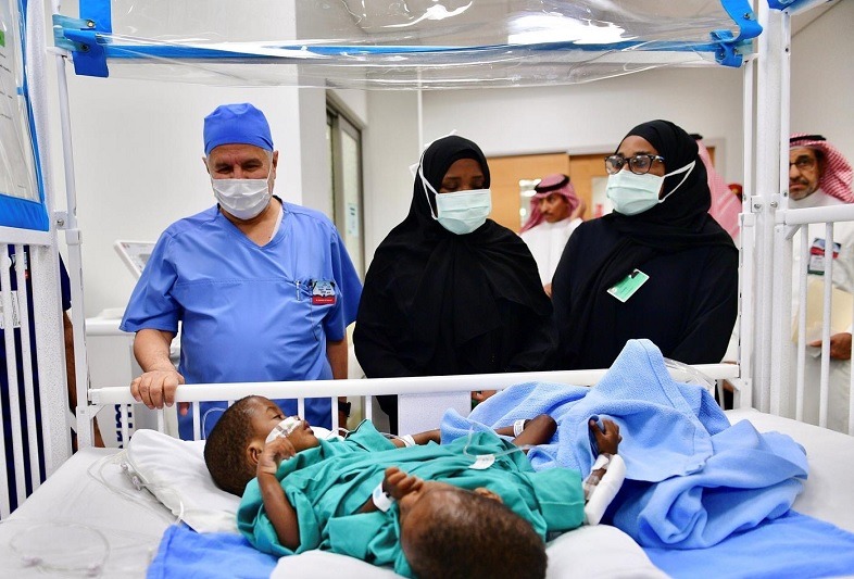 35 Saudi docs begin 16-hr surgery to separate conjoined Tanzanian twins